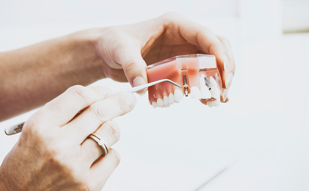 An Introduction To Dental Implants Oak Cliff Dental Center